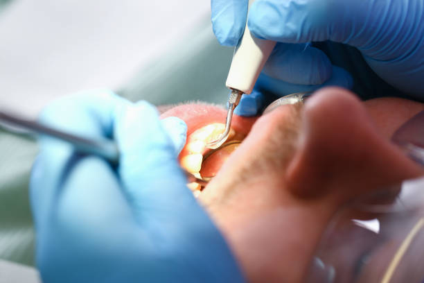 Best Weekend Emergency Dentist in Lancaster, WI
