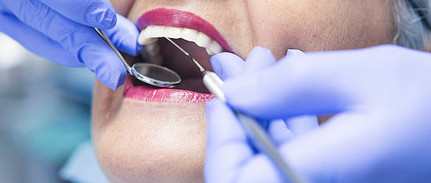Best Emergency Treatment for Dental Infections or Abscesses in Lancaster, WI